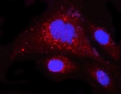 Immunofluorescent staining of FFPE human PC-3 cells with Myeloid cell leukemia 1 antibody (red) and DAPI nuclear stain (blue). HIER: steam section in pH6 citrate buffer for 20 min.