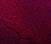 Immunofluorescent staining of FFPE human tonsil tissue with NDUFB7 antibody (red) and DAPI nuclear stain (blue). HIER: steam section in pH6 citrate buffer for 20 min.