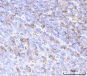 IHC staining of FFPE human tonsil tissue with PRTN3 antibody. HIER: boil tissue sections in pH8 EDTA for 20 min and allow to cool before testing.
