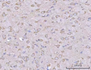 IHC staining of FFPE rat brain tissue with Liprin alpha 2 antibody. HIER: boil tissue sections in pH8 EDTA for 20 min and allow to cool before testing.