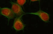 Immunofluorescent staining of FFPE human U-2 OS cells with PAPSS2 antibody (red) and Beta Tubulin mAb (green). HIER: steam section in pH6 citrate buffer for 20 min.