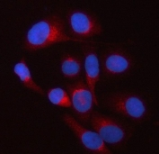 Immunofluorescent staining of FFPE human HeLa cells with TWF2 antibody (red) and DAPI nuclear stain (blue). HIER: steam section in pH6 citrate buffer for 20 min.