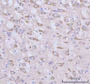 IHC staining of FFPE rat brain tissue with Rabphilin 3A antibody. HIER: boil tissue sections in pH8 EDTA for 20 min and allow to cool before testing.