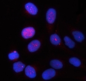 Immunofluorescent staining of FFPE human HeLa cells with TTC9 antibody (red) and DAPI nuclear stain (blue). HIER: steam section in pH6 citrate buffer for 20 min.