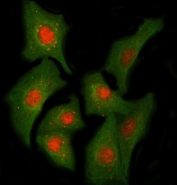 Immunofluorescent staining of FFPE human A549 cells with Cyp60 antibody (red) and Beta Tubulin mAb (green). HIER: steam section in pH6 citrate buffer for 20 min.