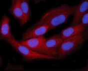 Immunofluorescent staining of FFPE human HeLa cells with TTC38 antibody (red) and DAPI nuclear stain (blue). HIER: steam section in pH6 citrate buffer for 20 min.