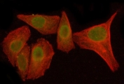 Immunofluorescent staining of FFPE human SiHa cells with IKB zeta antibody (green) and Beta Tubuliln mAb (red). HIER: steam section in pH6 citrate buffer for 20 min.