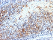 IHC staining of FFPE human tonsil with Cdc20 antibody (clone AR12). HIER: boil tissue sections in pH 9 10mM Tris with 1mM EDTA for 20 min and allow to cool before testing.
