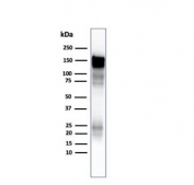 Western blot testing of A431 lysate using EGFR antibody at 1ug/ml. Expected molecular weight: 134-180 kDa depending on glycosylation level.
