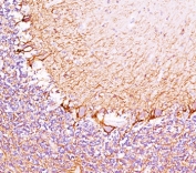 Neurofilament Heavy antibody RT97 immunohistochemistry cerebellum