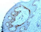 IHC staining of FFPE human skin with Nucleoli Marker antibody. HIER: boil tissue sections in pH6, 10mM citrate buffer, for 10-20 min and allow to cool before testing.