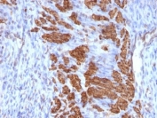 IHC: Formalin-fixed, paraffin-embedded rat uterus stained with Calponin antibody (CNN1/832 + CALP).