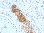 IHC: Formalin-fixed, paraffin-embedded human colon stained with NCAM antibody (NCAM1/784)