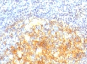 IHC: Formalin-fixed, paraffin-embedded human tonsil stained with VCAM1 antibody (VCAM1/843).