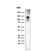 Western blot testing of human ovary tissue with CAD antibody (clone h-CALD). Predicted molecular weight ~93 kDa, can be observed at 70-80 kDa (non muscle tissue) and 120-150 kDa (smooth muscle).