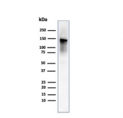 Western blot testing of human ovary tissue lysate using Caldesmon antibody (clone rCALD1/820). Predicted molecular weight ~93 kDa, can be observed at 70-80 kDa (non muscle tissue) and 120-150 kDa (smooth muscle).