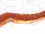 IHC: Formalin paraffin human skin stained with Acidic Cytokeratin antibody (KRTL/1077).