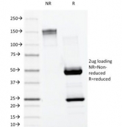 SDS-PAGE Analysis of Purified, BSA-Free Lambda Antibody (clone LAM03). Confirmation of Integrity and Purity of the Antibody.