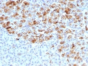 IHC testing of FFPE human pancreas with Alpha-1-Antichymotrypsin antibody (clone AACT/1452). Required HIER: steam sections in pH6, 10mM citrate buffer for 10-20 min.