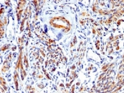 IHC testing of FFPE human uterus with recombinant Caldesmon antibody. Required HIER: boil tissue sections in 1mM EDTA, pH 7.5-8.5, for 10-20 min.