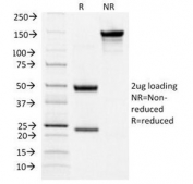 SDS-PAGE Analysis of Purified, BSA-Free TSHR Antibody (clone TSHRA/1404). Confirmation of Integrity and Purity of the Antibody.