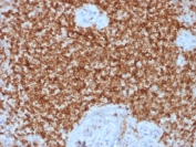 IHC testing of FFPE human spleen tissue with recombinant Bcl2 antibody (clone BCL2/1878R). HIER: boil tissue sections in 1mM EDTA buffer, pH 7.5-8.5, for 10-20 min followed by cooling at RT for 20 min.