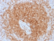IHC testing of FFPE human spleen with recombinant CD79a antibody (clone rIGA/764). Required HIER: boil tissue sections in pH 9 10mM Tris with 1mM EDTA for 10-20 min followed by cooling at RT for 20 min.