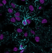 Immunofluorescent staining of frozen human cerebral cortex tissue with recombinant GFAP antibody (blue, clone ASTRO/1974R) and Histone H1 antibody (magenta, clone HH1/957).