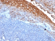 IHC testing of FFPE human tonsil with CD146 antibody (clone rMUC18/1130). Required boiling tissue sections in 10mM Tris with 1mM EDTA, pH8, for 10-20 min followed by cooling at RT for 20 min.