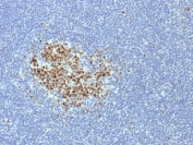 IHC testing of FFPE human tonsil tissue with Bcl6 antibody (clone BCL6/1718). HIER: boil tissue sections in 10mM Tris with 1mM EDTA, pH 9, for 10-20 min followed by cooling at RT for 20 min.