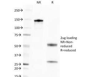SDS-PAGE analysis of purified, BSA-free BCMA antibody (clone BCMA/2366) as confirmation of integrity and purity.