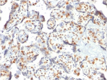 IHC testing of FFPE human placenta with Dnmt3a antibody. Required HIER: boil sections in 1mM EDTA, pH 9, for 10-20 min and allow to cool before testing.