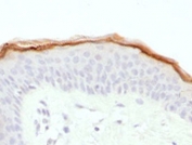 IHC testing of FFPE human skin with Filaggrin antibody (clone FLG1-1). Required HIER: boil tissue sections in pH 9 10mM Tris with 1mM EDTA for 10-20 min.