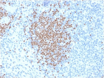 IHC testing of human lymph node with PAX5 antibody (clone PCRP-PAX5-1B1). Required HIER: boil tissue sections in 10mM citrate buffer, pH 6, for 10-20 min followed by cooling at RT for 20 min.