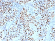 IHC testing of FFPE human lymph node with OCT-2 antibody (clone OCT2/2136). HIER: boil tissue sections in pH6, 10mM citrate buffer, for 10-20 min followed by cooling at RT for 20 min.