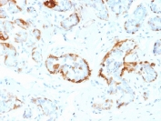 IHC staining of FFPE human breast tissue with CRYAB antibody (clone CPTC-CRYAB-1). HIER: boil tissue sections in pH6, 10mM citrate buffer, for 10-20 min and allow to cool before testing.