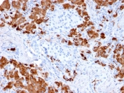IHC testing of FFPE human pancreas with Carboxypeptidase A1 antibody (clone CPA1/2712). HIER: boil tissue sections in pH6, 10mM citrate buffer, for 10-20 min followed by cooling at RT for 20 min.
