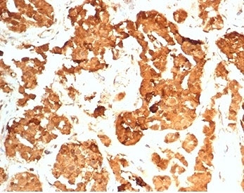 IHC staining of FFPE human pituitary gland tissue with HCG-beta antibody (clone HCGb/7201R). HIER: boil tissue sections in pH 9 10mM Tris with 1mM EDTA for 20 min and allow to cool before testing.~