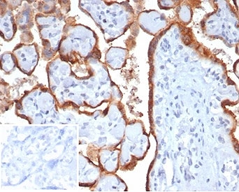 IHC staining of FFPE human placental tiss
