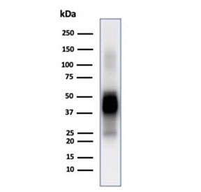 Western blot testing of human brain tissue lysate using GFAP antibody (clone GFAP/6884). Predicted molecular weight ~50 kDa.~