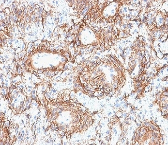 IHC staining of FFPE human kidney tissue with FBN1 a
