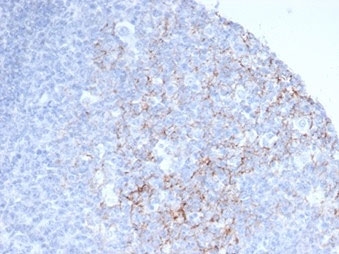 IHC staining of FFPE human tonsil tissue with CD23 antibody (clone FCER2/6888). HIER: boil tissue sections in pH 9 10mM Tris with 1mM EDTA for 20 min and allow to cool before testing.~