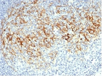 IHC staining of FFPE human lymph node tissue with CD23