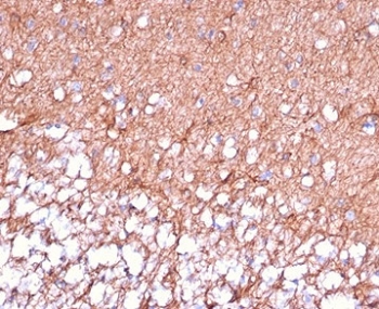 IHC staining of FFPE human cerebellum tissue with GFAP antibody (clone GFAP/6880). HIER: boil tissue sections in pH 9 10mM Tris with 1mM EDTA for 20 min and allow to cool before testing.~