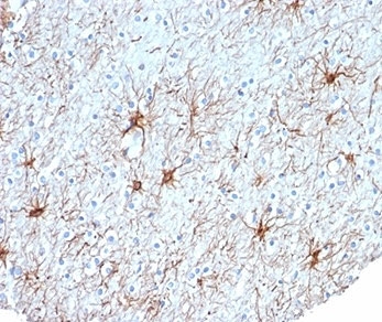 IHC staining of FFPE human cerebral cortex tissue w
