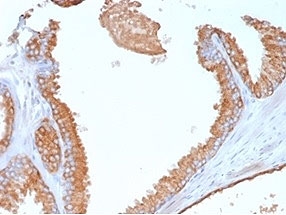 IHC staining of FFPE human prostate tissue with Glypican-3 antibody (clone GPC3/7107). HIER: boil tissue sections in pH 9 10mM Tris with 1mM EDTA for 20 min and allow to cool before testing.~
