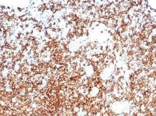IHC staining of FFPE human tonsil with CD13 antibody (clone APN/6998). HIER: boil tissue sections in pH 9 10mM Tris with 1mM EDTA for 20 min and allow to cool before testing.~