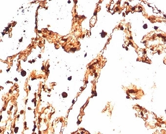 IHC staining of FFPE human lung tissue with S100