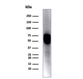 Western blot testing of A431 cell lysate with KRT14 antibody (clone KRT14/4128). Predicted molecular weight ~53 kDa.~