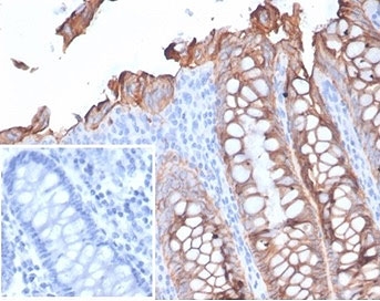 IHC staining of FFPE human colo